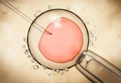 液氮存储